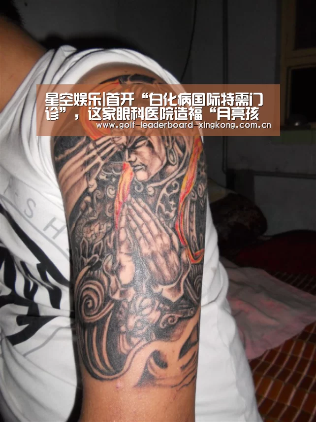 星空娱乐|首开“白化病国际特需门诊”,这家眼科医院造福“月亮孩子”(图2) 星空体育娱乐